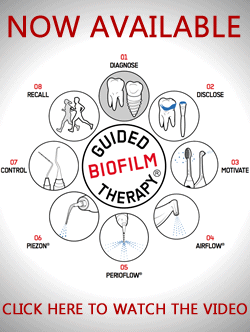 Guided Biofilm Therapy